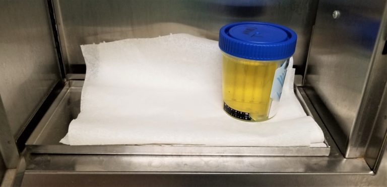 Urine Drug Testing
